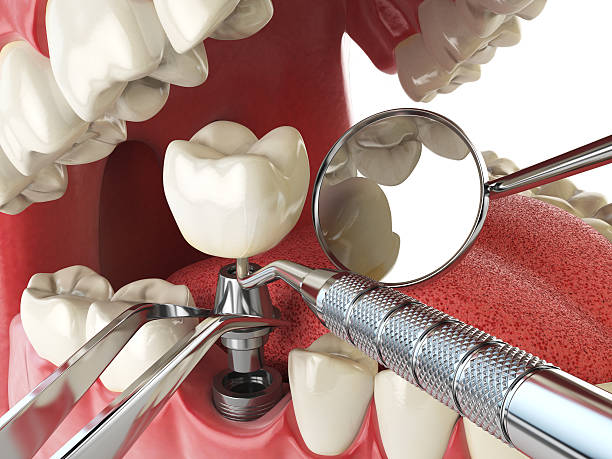 Best Emergency Treatment for Oral Infections in Flagstaff, AZ